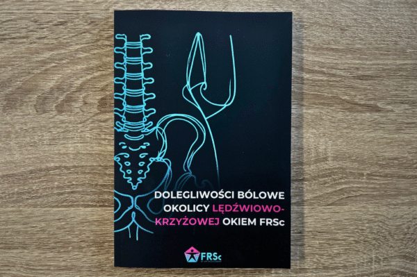 Dolegliwości bólowe okolicy lędźwiowo-krzyżowej okiem FRSc